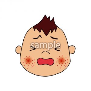 赤ちゃん発疹の画像